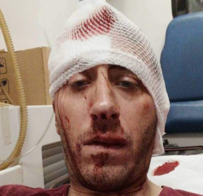 Banja Luka: Brutalno pretučen novinar BN TV Vladimir Kovačević